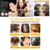 West Month Hair Growth Nutrient Oil For Lush And Thick Hair Nourishing Care 30ml