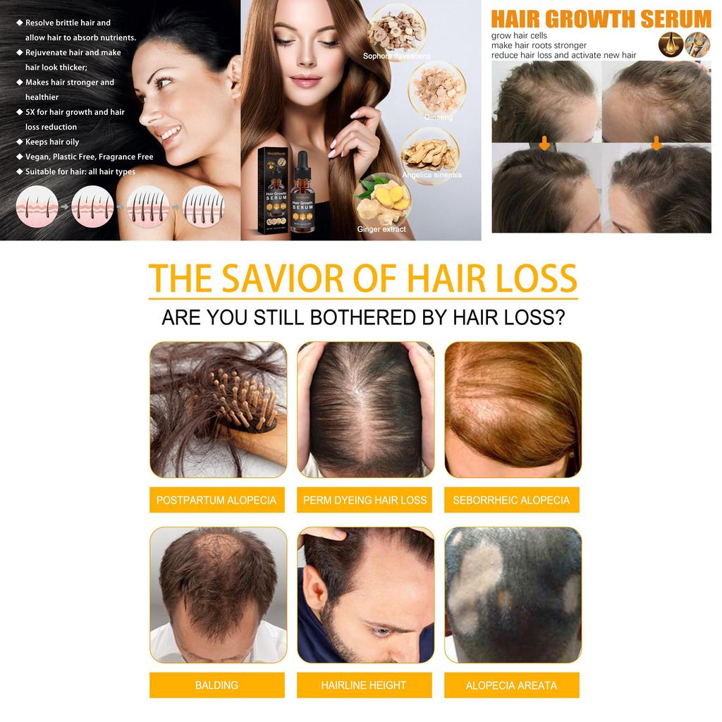 West Month Hair Growth Nutrient Oil For Lush And Thick Hair Nourishing Care 30ml