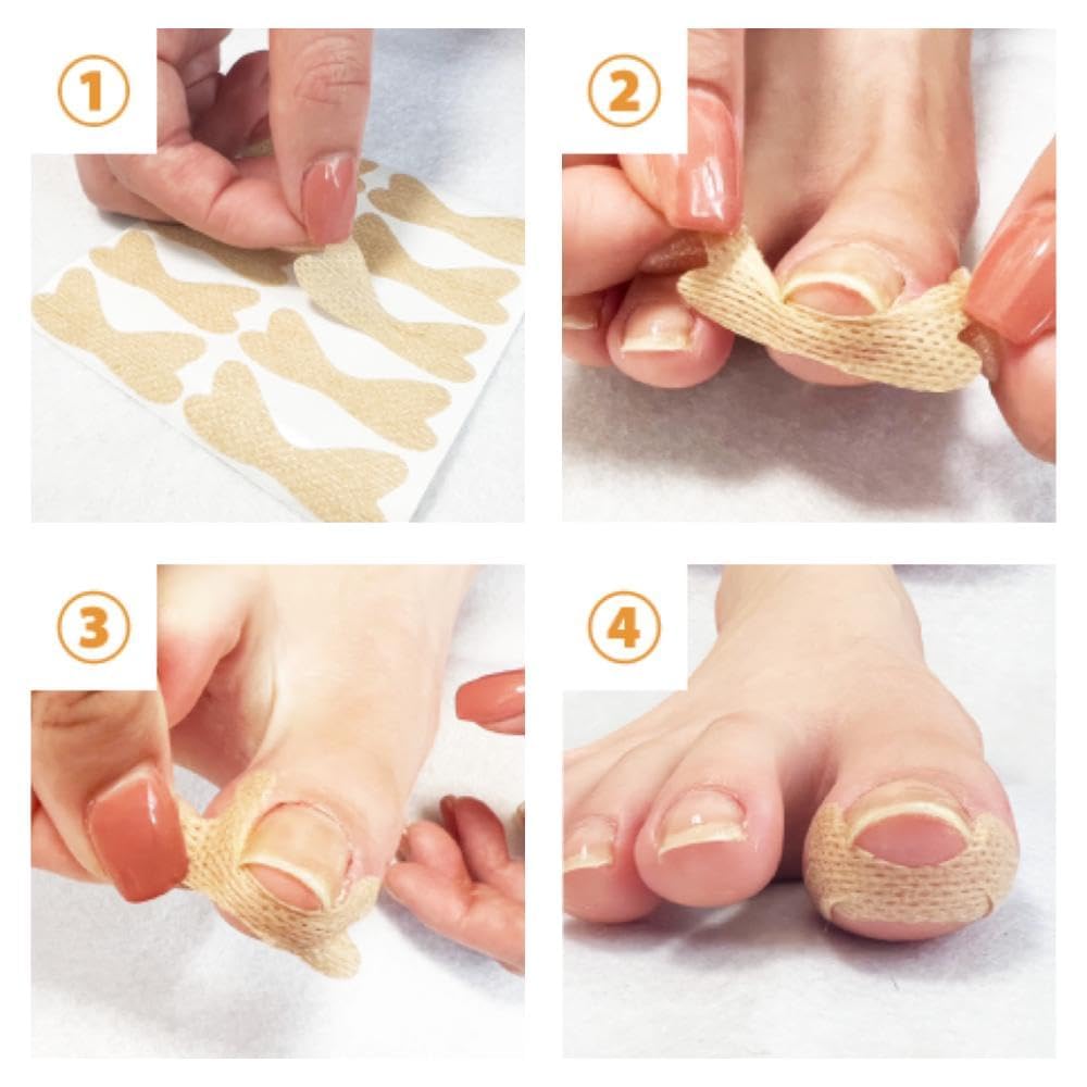 By Ingrown Nail Tsumerakku Ingrown Nail Tape Adhesive X Breathable Easy To Ingrown and Nail Tape Original Foot Comfort Workshop 40 [Supervised