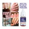 Ouhoe Nail Repair Solution Thickening Treatment For Ingrown Nails And Fungal Issues