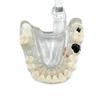 Dental Educational Model, Zamo®, Used To Exemplify Dental Pathologies, 31 Teeth, Transparent