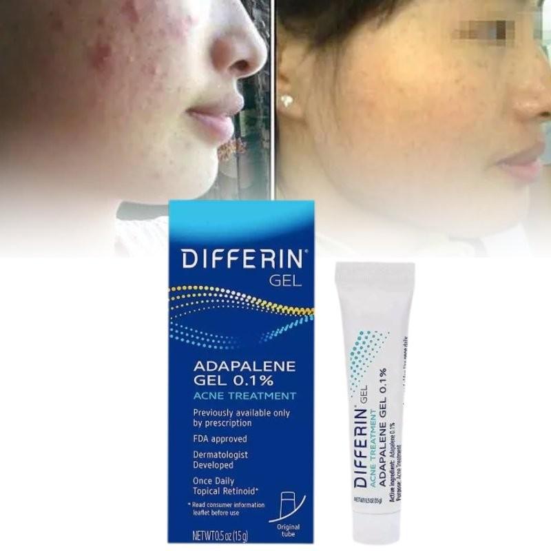 Differin Gel Traitement Acné Gel Rétinoïde Pour Peau Claire Radieuse 15g
