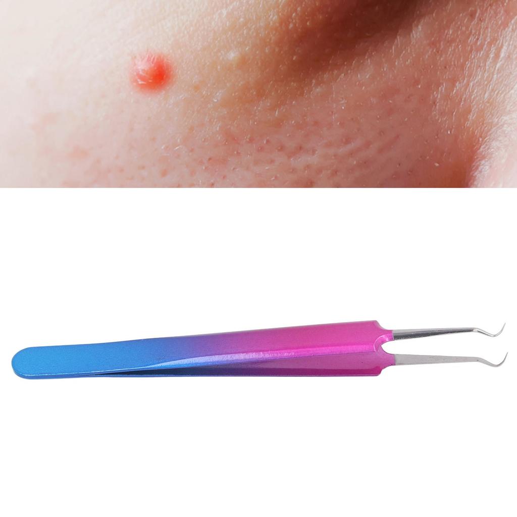Curved Tip Blackhead Extractor Tweezer Stainless Steel Precise Blemishs Pimple Blackhead Removal Tool