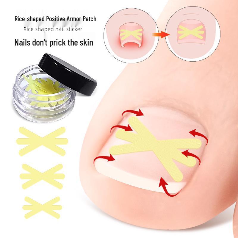 Star-Shaped Ingrown Toenail Correction Patch