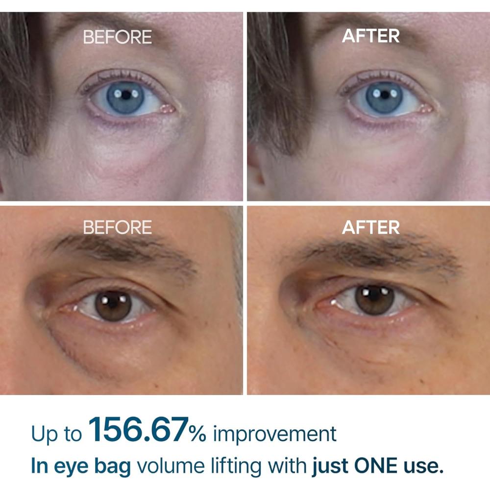 Dr.Melaxin Eyephalt Krém na oční váčky 7g