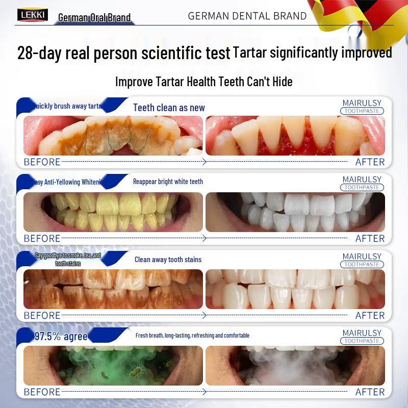 LEKKI Tartar Removal & Whitening Toothpaste