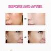 Arbutin & Tranexamic Acid Face Cream – Brightening & Hydrating Treatment for Uneven Skin Tone less