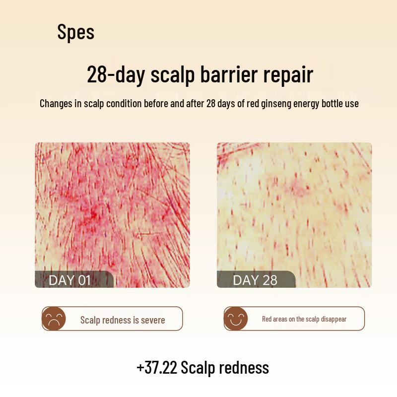 Spes Red Ginseng Oil Control & Anti-Dandruff Hair Care Set with Sweet Pomelo