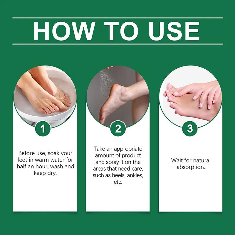 Herbal Anti Crack Foot Cream Peeling Spray Heel Cracking Repair Products Exfoliation Dead Skin Removal Softening Smooth Care