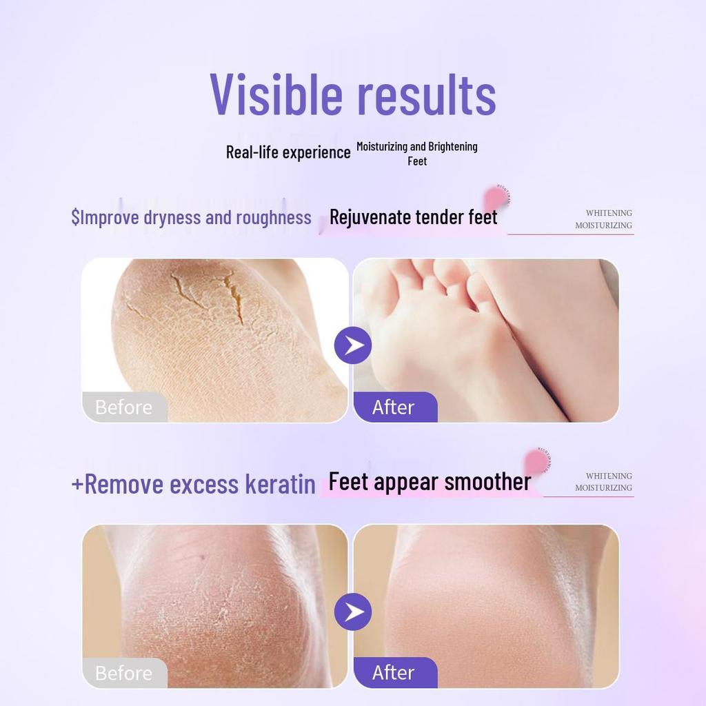 Gentle Hydrating Foot Mask for Nourishing and Moisturizing Dry, Cracked Skin