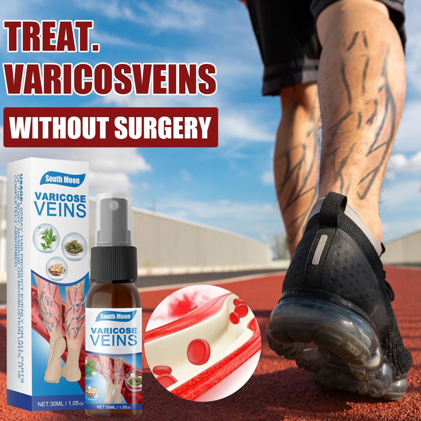 

Vein Varicose Veins Spray, Vein Varicose Veins Soothing Spray для ног, удаление варикозного расширения вен 30 мл