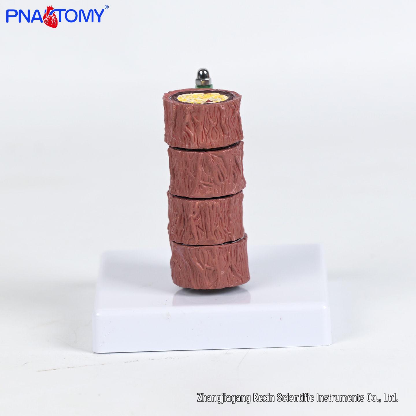 Anatomically Accurate Four-Stage Arteriovenous Vascular Model with Lesions for Clinical Teaching and Atherosclerosis Thrombus Training Size PNT-0735a
