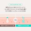 OBgE Pore Zero Peeling Toner 310ml cica niacinamide for sensitive and dark High-concentration skin, dullness, sebum, spots.