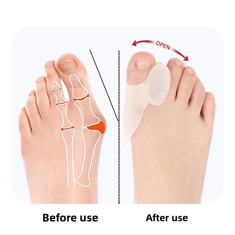 Silicone Big Toe Hallux Valgus Split Toe Corrective Care Cover, Big Foot Bone Separation