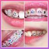 6 Grid Dental Rhinestones Tooth Rhinestones Teeth Jewelry Teeth Whitening Teeth Decoration Dental Crystal