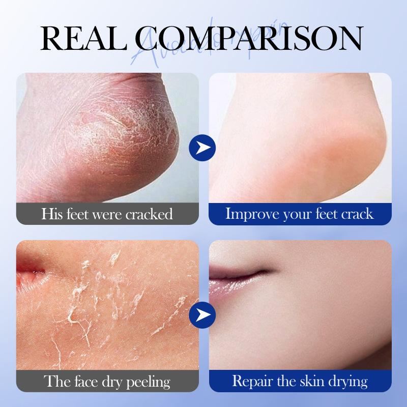 Vaseline Avocado Moisturizing Stick 40g SADOER Anti-Dry and Cracked Foot Cream