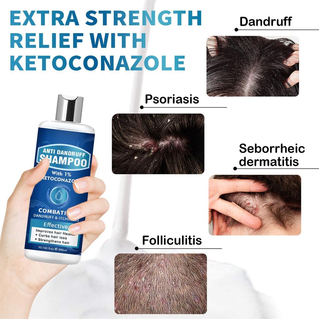 Soothing Scalp Shampoo, Hair Care, Strong Hair, Refreshing Oil Control, Smooth And Shiny Shampoo 300ml