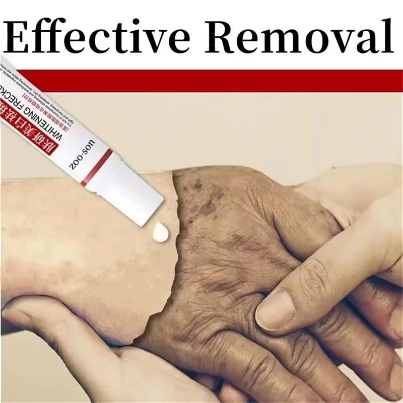 Whiten Cream Brighten Face Effective Remove Melasma Dark Spot Improve Dullness Skin Anti-pigmentation Care Cream Care Products