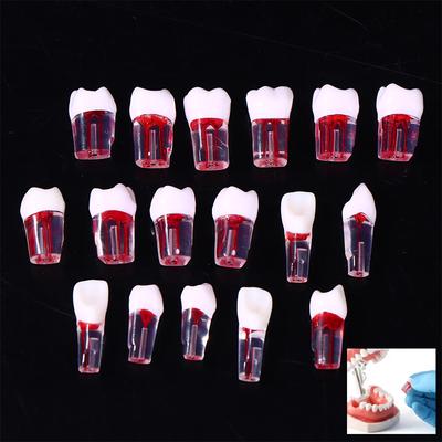 5/10Pcs Dental Rct Teeth Model Endodontic Practice Root Canal Block Pulp Cavity Resin Study Tooth Dentistry Teaching Material