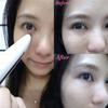 LIFETRONS - Eye Rejuvenator With Radio Frequency, Ion & Heat Therapy