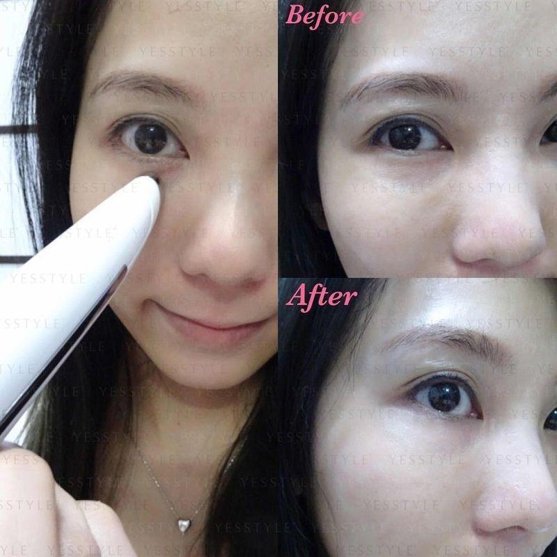 LIFETRONS - Eye Rejuvenator With Radio Frequency, Ion & Heat Therapy