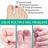 5Pcs Extra Strong Nail Fungus Treatment Serum Essence Care Repair Essence Anti Toe Infection Gel Feet Serum Removal Nails Fungal