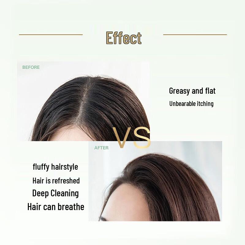 Shu Lei Green Tea Seed Anti-Dandruff Oil Control Shampoo