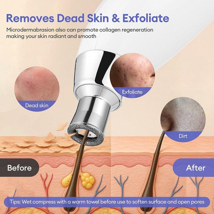 7 Gear Suction Diamond Microdermabrasion Machine -60KPa Handhold Diamond Facial Device Remove Blackhead Skin Exfoliate Tool