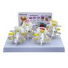 Human Skeleton Model for Anatomy Lumbar Spine 4 Stages Lesions Comparative Model Lumbar Vertebrae Model Nursing Model