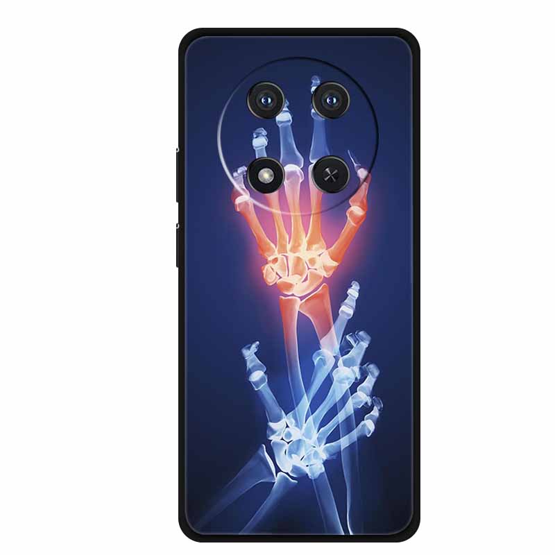 For Honor X9c Case X 9 c Coque Flowers Black Silicone TPU Soft Back Cover For Honor Magic 7 Pro Magic7 5G lite Phone Case Funda
