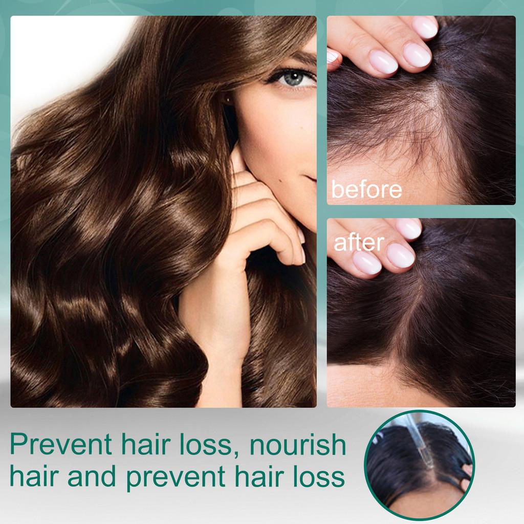 Eelhoe Nourishing Ginger Hair Oil For Dry Frizzy Hair With Ultimate Shine And Smoothness