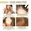 Rosemary Hair Oil Treatment for Damaged Hair, Smoothing Frizz, Nourishing Shine, Mild Hair Care Essence for All Hair Types