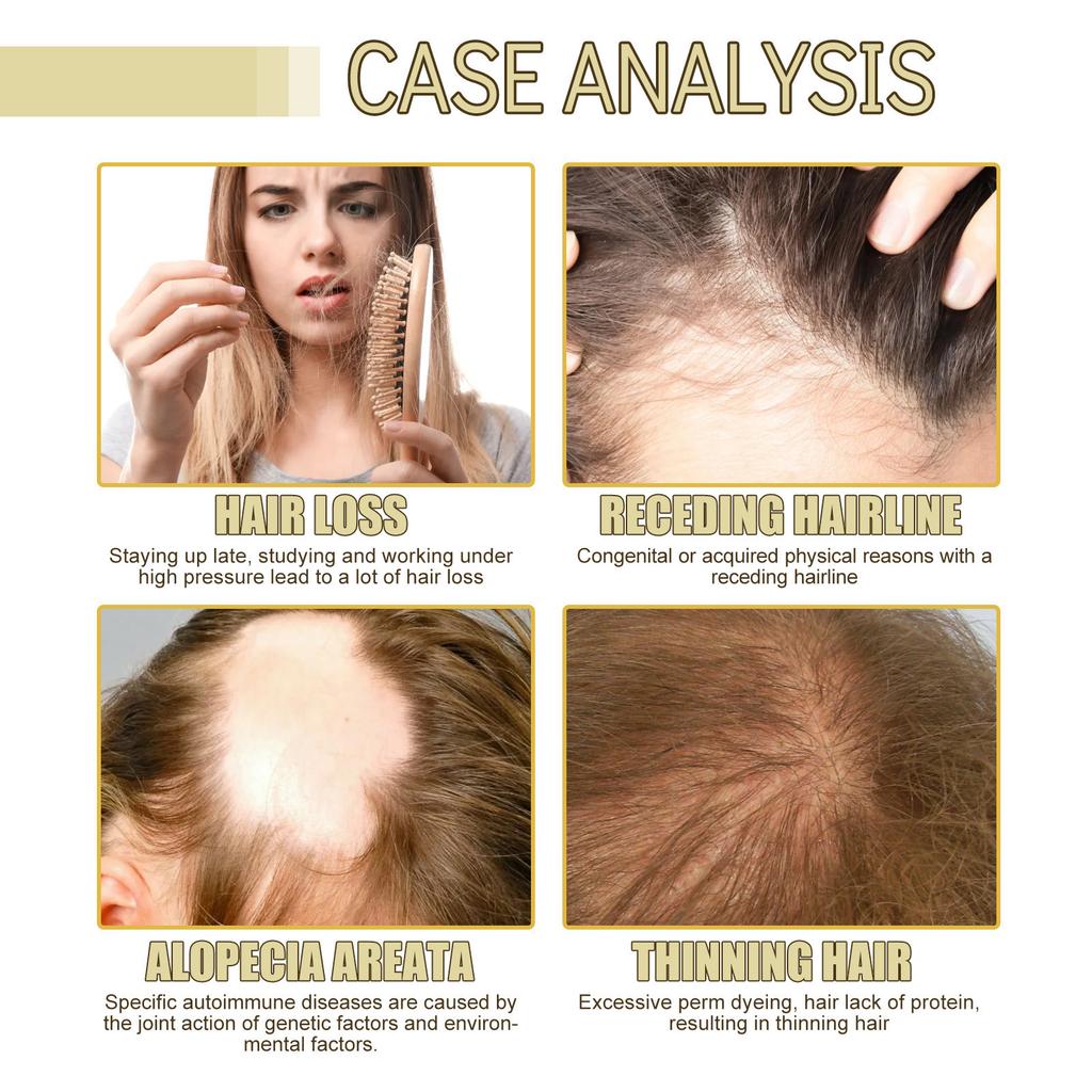 Rosemary Hair Oil Treatment for Damaged Hair, Smoothing Frizz, Nourishing Shine, Mild Hair Care Essence for All Hair Types