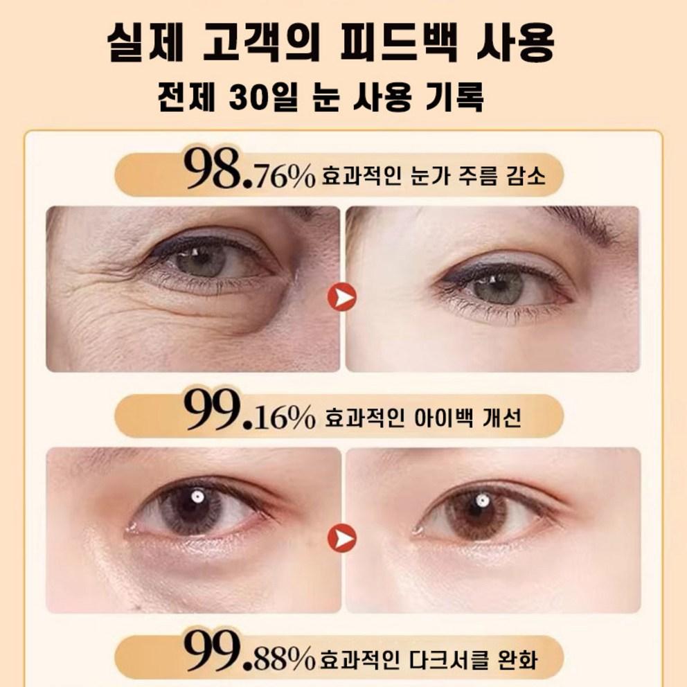 [Utherable] 900 Shots Intense Eye Lifting Cream (15g) - Derm Recommended