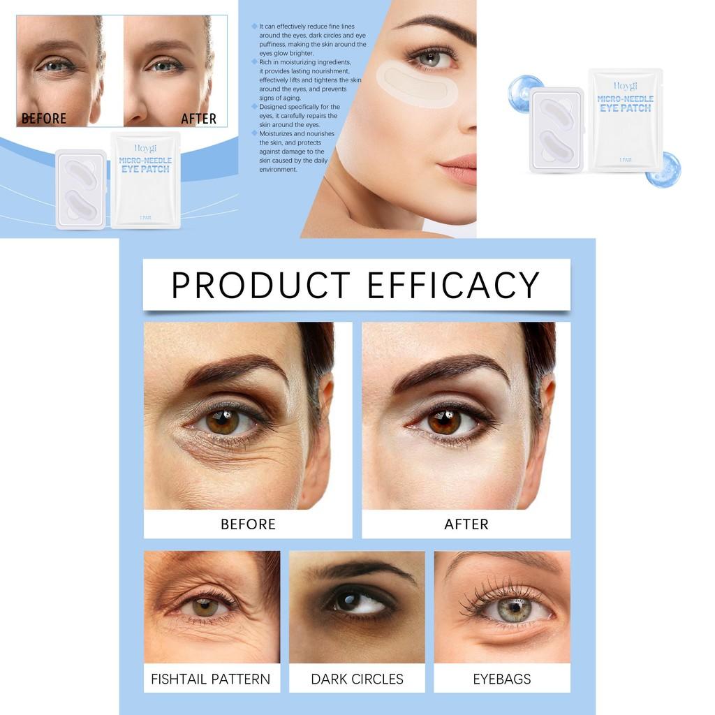 Hoygi Hydrating Eye Masks For Moisturizing And Revitalizing Dull Skin Under Eyes