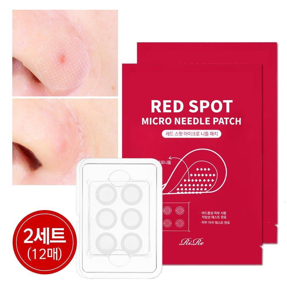 

RIRE Red Spot Micro Needle Acne Patch 2 Sets (12 Pieces)