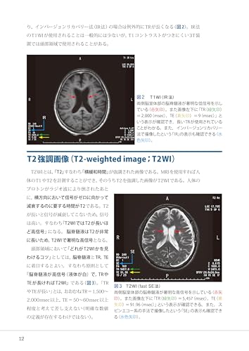 Mastering Head CT and MRI Imaging and Interpretation