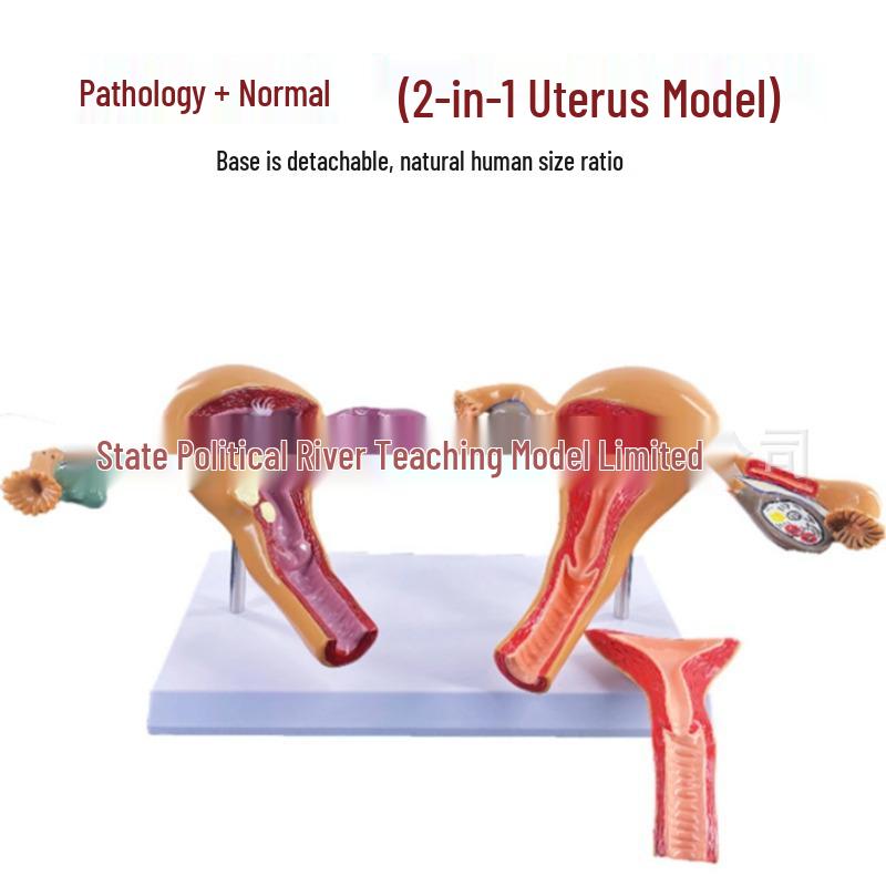 Sieviešu reproduktīvās sistēmas anatomijas modelis ginekoloģijas