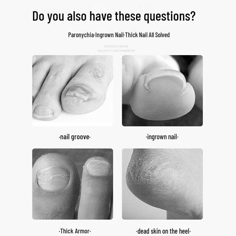 Xingfutang Pediküre-Messer-Set