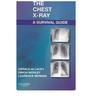 Chest X-Ray A Survival Guide A Survival Guide Paperback IND-21