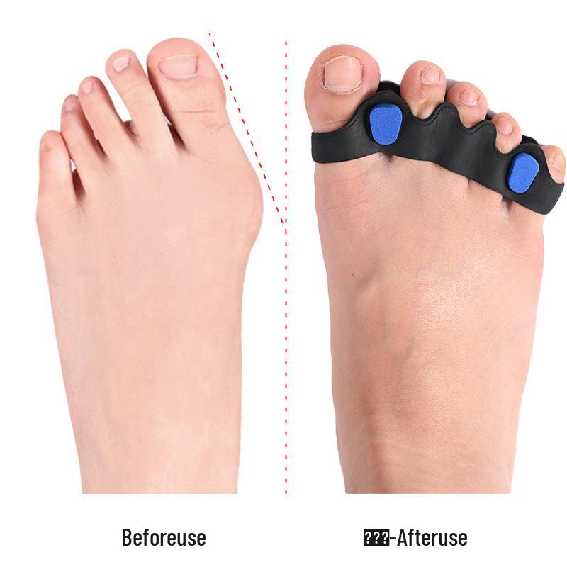 Verstellbarer Silikon-Zehenkorrektor für überlappende Hallux Valgus
