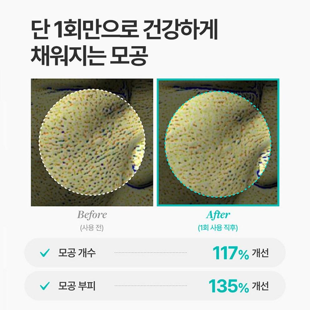 [Meditherapy] Poresera Gerçek Bifida Blur Krem 50ml