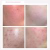 Rdrd Pink Apple Lacto Barrier Popping Toner - Barrier, Soothing 95g