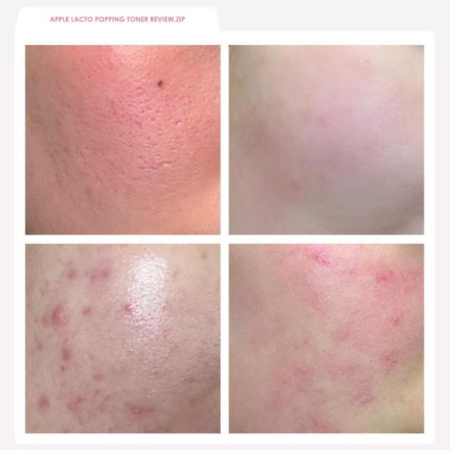 Rdrd Pink Apple Lacto Barrier Popping Toner - Barrier, Soothing 95g