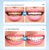 Teeth Whitening Powder: Removes stains, cleans tartar and plaque, refreshes breath, ideal for smokers and coffee drinkers.