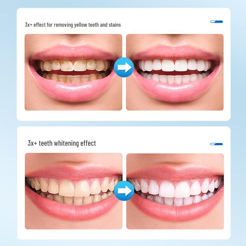 Teeth Whitening Powder: Removes stains, cleans tartar and plaque, refreshes breath, ideal for smokers and coffee drinkers.