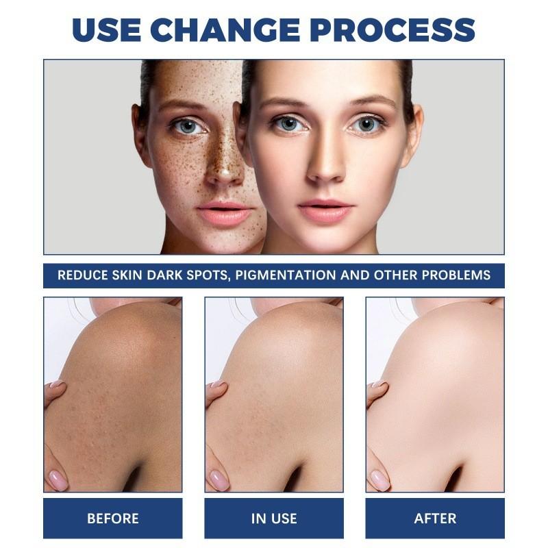 Jaysuing Spot Cleanser Lotion 150ml For Deep Facial And Body Cleansing To Brighten And Fade Spots