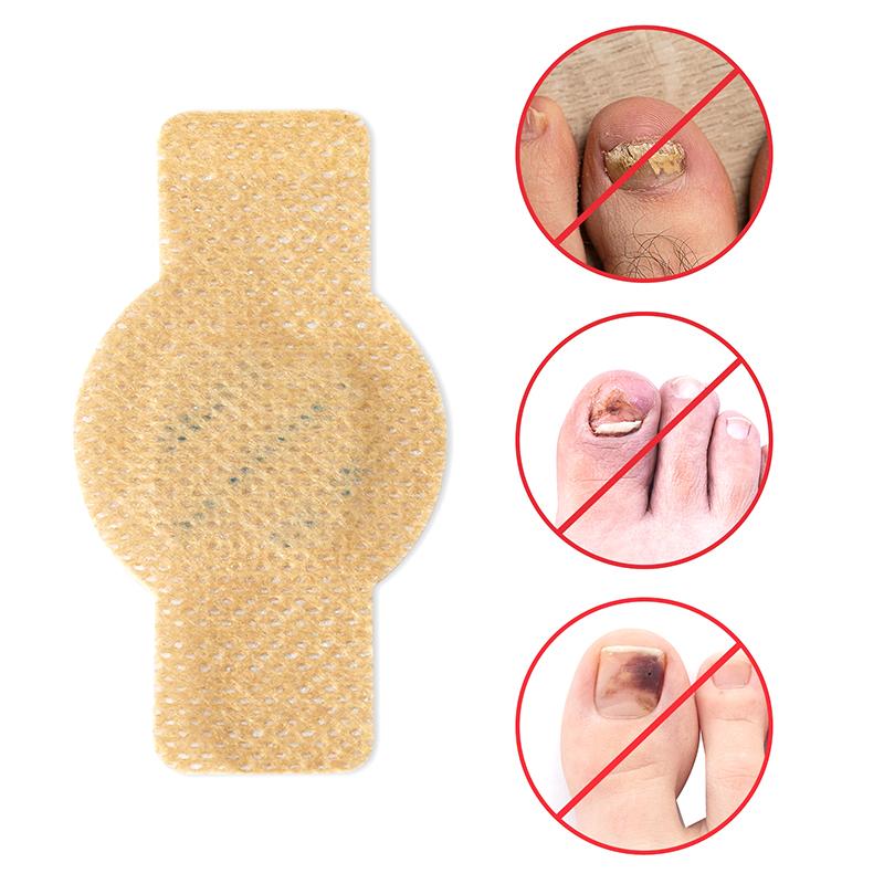 21 buc. Plasturi pentru ciuperca unghiei, Impermeabili, Plasturi pentru repararea unghiei, Autocolant pentru corectarea unghiei incarnate, Plasturi de îngrijire pentru unghii decolorate, deteriorate, gri