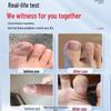 Tongrentang Nail Fungus Repair Treatment