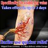 Natural Varicose Veins Ointment - Relieves Pain & Swelling Skin-Friendly